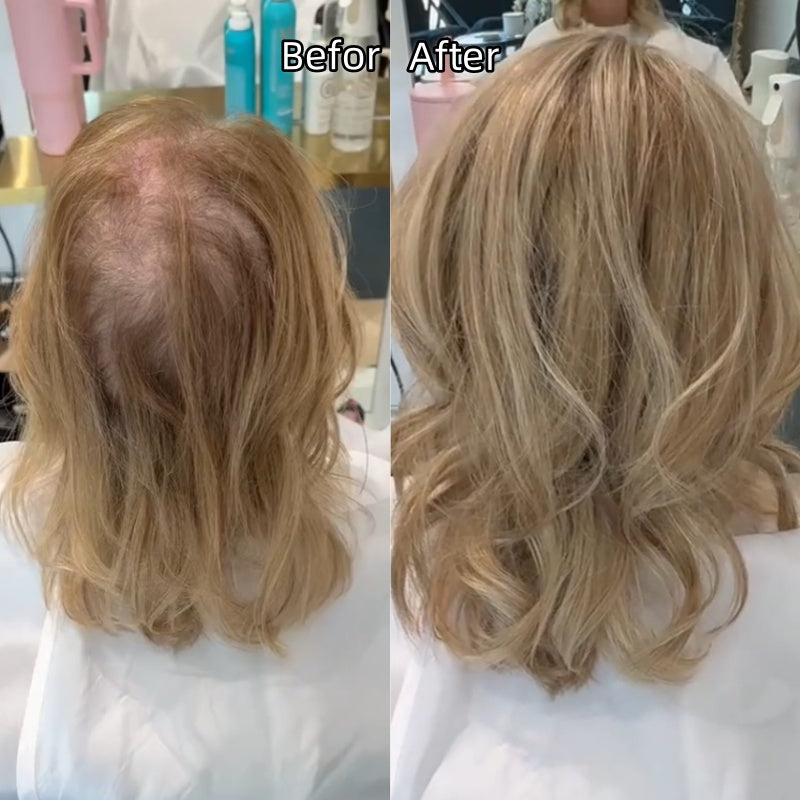 ✨Lightweight Human Hair Topper for Thinning Hair 💁‍♀️ Instantly Fuller, 🌿Natural-Looking Volume Without Heavy Wigs — 🔥40% OFF Today Only!